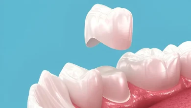 Unpacking the Costs of Dental Crowns: A Guide for Sydney Residents