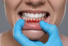 Winter Smog and Gum Health