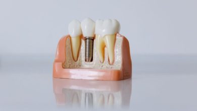Implant Supported Dentures Offer Stability and Confidence